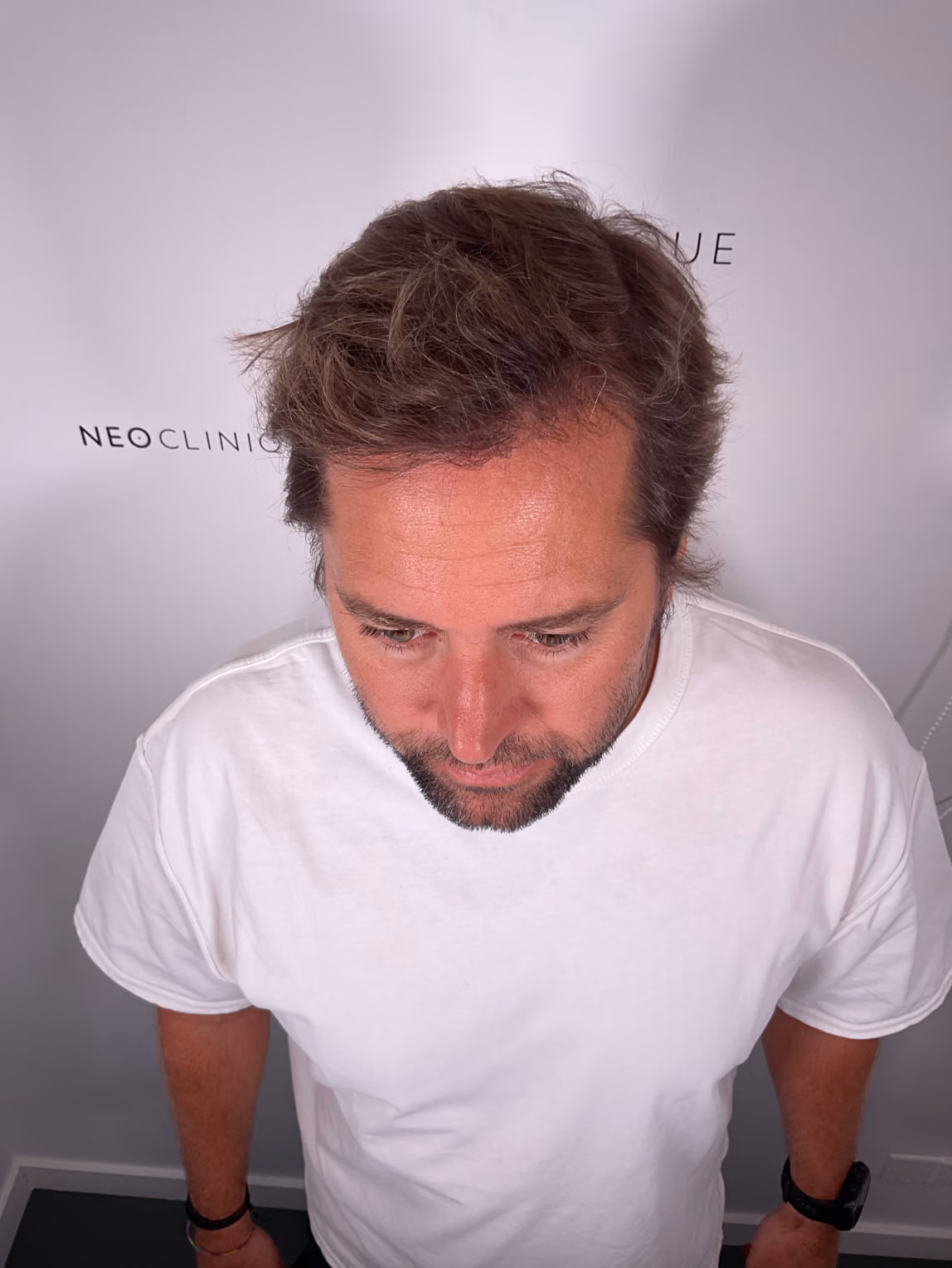 Après